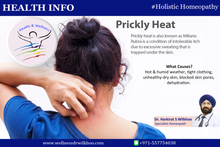 Heat Rash or Prickly Heat (Miliaria Rubra) Condition, Treatments